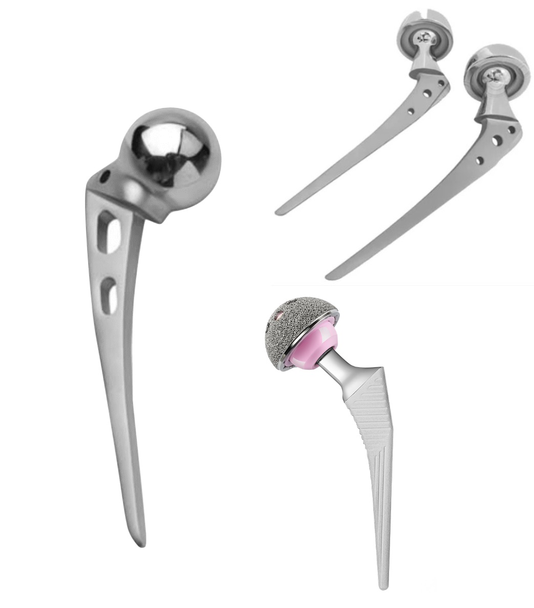 Hemi-Arthroplasty